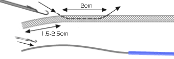 ループ-2